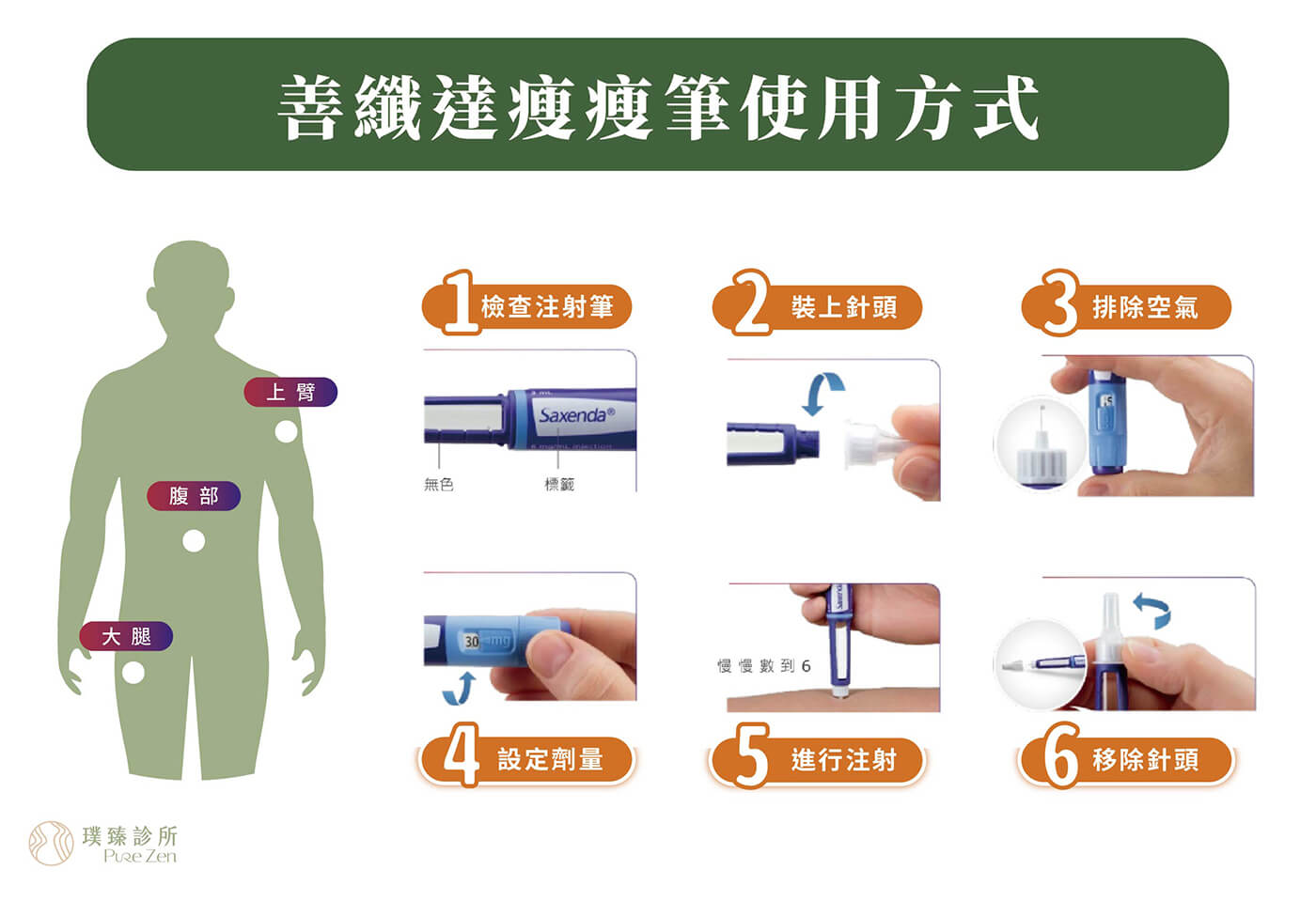 善纖達瘦瘦筆使用方式 1.取下筆蓋檢查溶液，確認瘦瘦筆中的溶液是否透明無色2.拿取新的針頭，撕下保護片，將針頭筆直推入注射筆，確實旋緊3.全新拆封的瘦瘦筆第一次注射前，須先排除空氣4.設定劑量，轉動調整旋軸，直至劑量指示窗顯示欲施打的劑量數字。若選錯劑量，可往前或往回轉動到正確劑量5.按下筆身尾端按鈕進行注射，聽到或感覺到「喀擦聲」後，不要急著移開，慢慢數6秒鐘，以確保劑量完整注入6.移除針頭並小心棄置，記得將筆蓋套回，置於冰箱冷藏妥善保存，需於一個月內使用完畢